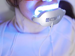 ホワイトニング液を塗布した歯にLEDライトを照射する